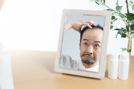 薄毛治療で選ぶべき治療薬とは?
