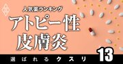 アトピー性皮膚炎で処方患者数の多い「人気薬」ランキング！新薬や“第3の抗炎症外用薬”は？