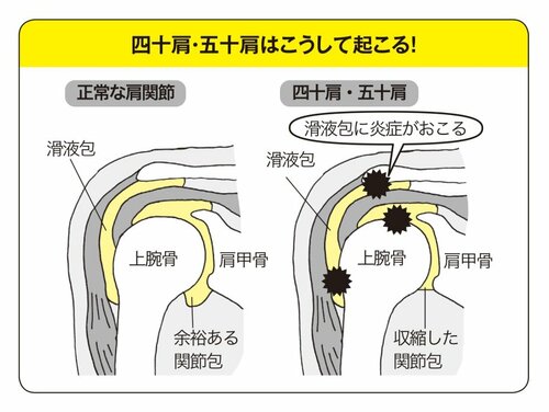 世界一受けたい授業 で話題 四十肩 五十肩の人は絶対やってみて フィジカルトレーナー 中野ジェームズ修一が教えるつらい肩こりを解消する 1分間ストレッチ ゆる筋トレ 10年後 後悔しない体のつくり方 ダイヤモンド オンライン