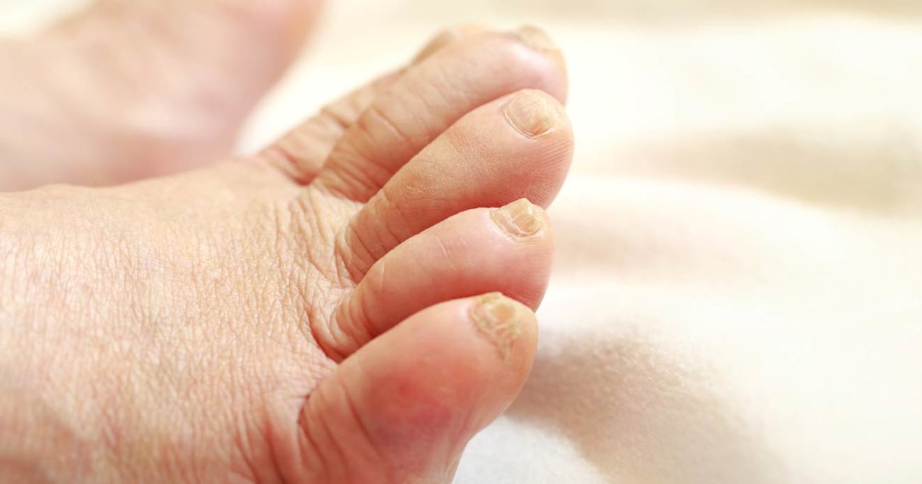 爪 臭い 足 の 親指 足の爪が臭いのは垢が原因！臭くならないためにやるべき2つの対策