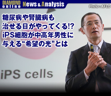 糖尿病や腎臓病も治せる日がやってくる!?iPS細胞が中高年男性に与える“希望の光”とは
