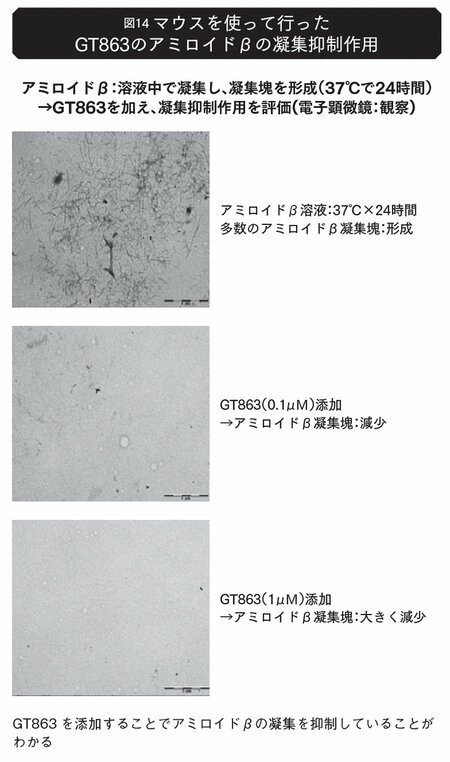 なぜインド人は認知症になりにくいのか？認知症研究の第一人者が注目した「意外な食べ物」とは？
