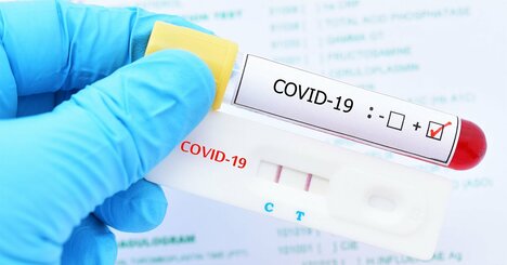 コロナに新しい検査法の可能性、4分で結果判明・正確性はPCRと同等