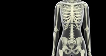 糖尿病の人は性別を問わず、「骨粗鬆症」にもなりやすい