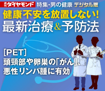 ［PET］頭頸部や卵巣の「がん」、悪性リンパ腫に有効