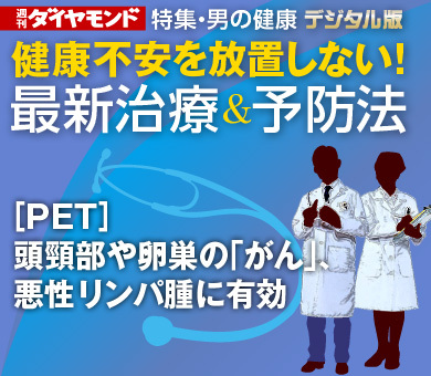 ［PET］頭頸部や卵巣の「がん」、悪性リンパ腫に有効