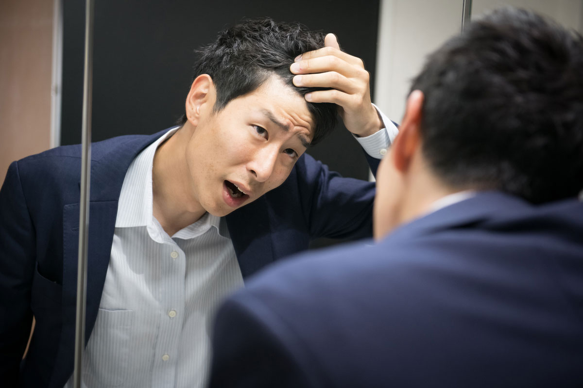 薄毛ではないのに気にする人が多い?