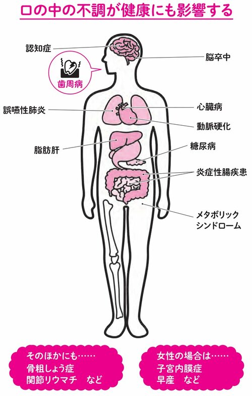 やせたいなら「歯磨き」が大事な理由、不十分だと太りやすい体質になることも