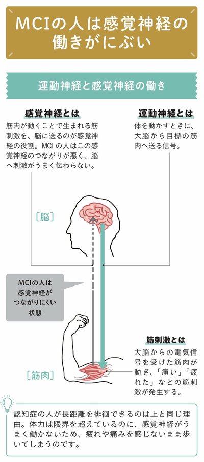 図解：MCIの人は感覚神経の働きがにぶい
