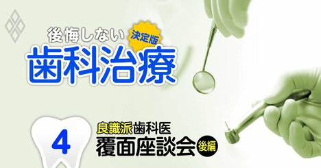 インプラント、矯正、歯周病…「ダメな治療」を歯科医師4人が赤裸々暴露【覆面座談会・後編】