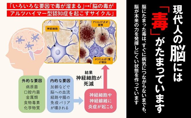 【認知症専門医が指摘】集中できない・物忘れが気になる…それ、“脳をにぶらせる物質”が原因かも