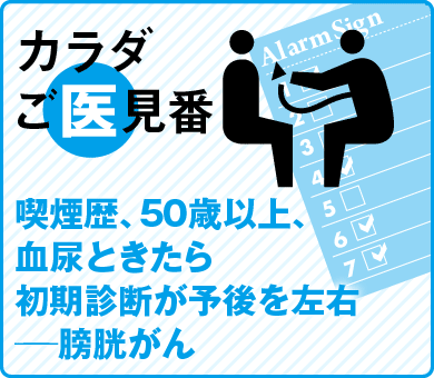 喫煙歴、50歳以上、血尿ときたら初期診断が予後を左右──膀胱がん