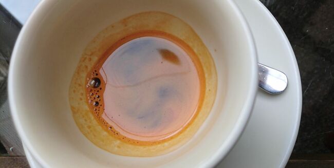 「尿からコーヒーの臭いがしたら警戒すべきこと」専門医が教える“面白い人体”の話