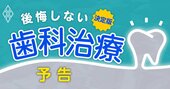 「歯の治療」で後悔しない全情報！歯科医の本音から治療と費用の裏側まで総力取材