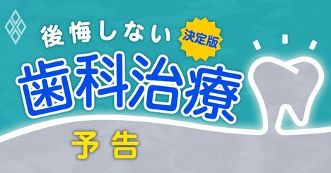 「歯の治療」で後悔しない全情報！歯科医の本音から治療と費用の裏側まで総力取材