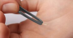 刺さった「トゲ」は放置しないで...2年後、女性の足に表れた恐ろしい「症状」、患部の写真を公開