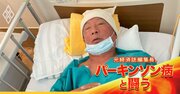 頭蓋骨に穴を開け電極を脳の深部へ…「男66歳、人生最後のトライ」の大手術を決心した理由