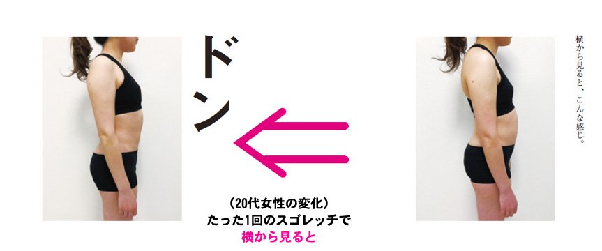 たった1回の「スゴレッチ」でぽっこりお腹が解消した20代女性