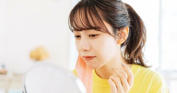 マスク着用で起きる皮膚トラブル 皮膚炎を起こした人の8割が「鼻の頭」という研究報告