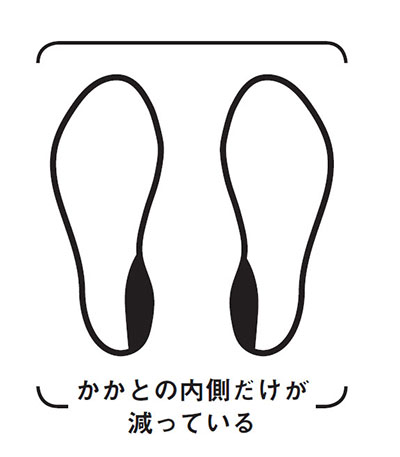 肩こりや腰痛の原因が かかと に 靴底の減り方でチェックを News Amp Analysis ダイヤモンド オンライン