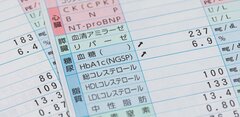 春の健康診断で異常があったら「早期受診」を！入院・死亡リスクに差