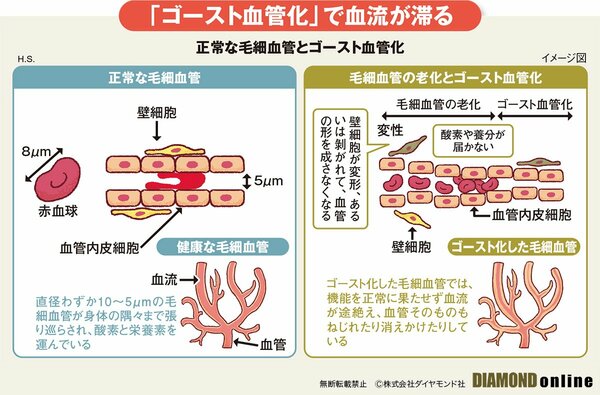 図_正常な毛細血管とゴースト血管化