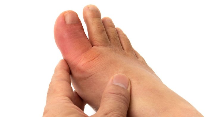 足の親指がむずむずする人は、あの病気がそこまで迫っている