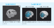 【サウナの科学】「ととのう」時、脳はどう変化している？