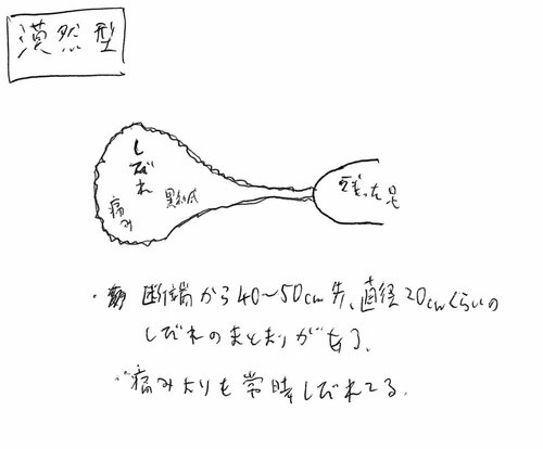 漠然型