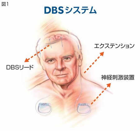 図1:DBSシステム