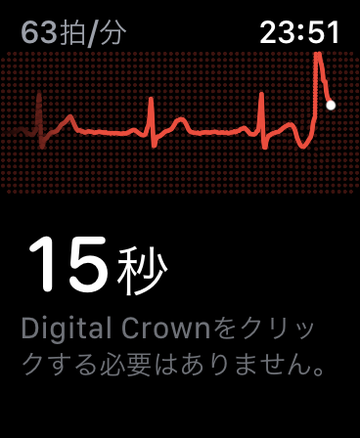 Apple Watch心電図機能を試す 使い方と注意点は