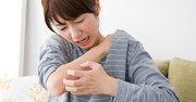 「謎の蕁麻疹」に悩み続けた妻、歯科医で判明した意外な原因