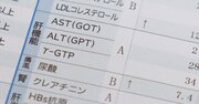 肝機能の推奨値を学会が初設定、「ALT（GPT）30超」は受診を