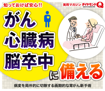 病変を局所的に切除する画期的な胃がん新手術