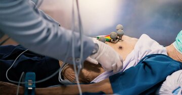 痛風および関節リウマチ患者の心臓手術件数が増え続けている実態