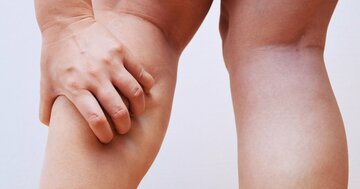 同じ体重なのに……「脚が細い人」と「太い人」の決定的な違い、意外な原因