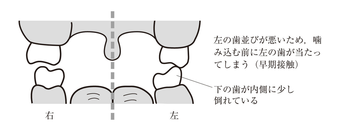 ガンコな肩こりが10分で解消、自宅でできる意外な方法とは?