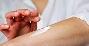アトピー性皮膚炎の新薬ラッシュ!それでも120万人超の患者に「画期的」治療薬が届かない理由
