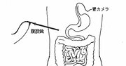 【外科医が教える】「内視鏡手術」のよくある誤解 胃カメラ、大腸カメラ、腹腔鏡はそれぞれどこを見ているのか？