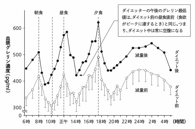【肥満外科医が教える】「常にお腹が空いている人」と「正常な食欲な人」の決定的違い