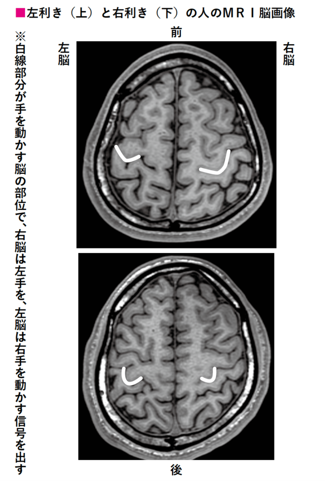 世界初の脳内科医は、なぜマイノリティの「左利き本」を書いたのか