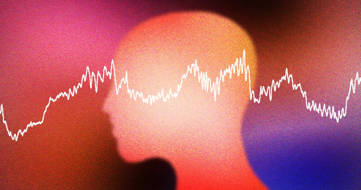 麻酔中の脳、通説よりも「昏睡状態」に近い可能性 - WSJ PickUp