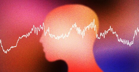 麻酔中の脳、通説よりも「昏睡状態」に近い可能性