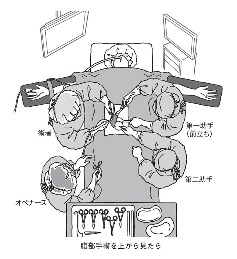 図・腹部手術を上から見たら
