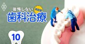 いい入れ歯はもう作れなくなる!?歯科医が恐れる「歯科技工士」クライシス