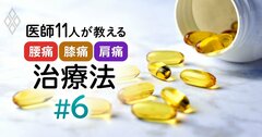 膝痛・関節痛にサプリは本当に効く？専門家による「利用の心得5カ条」