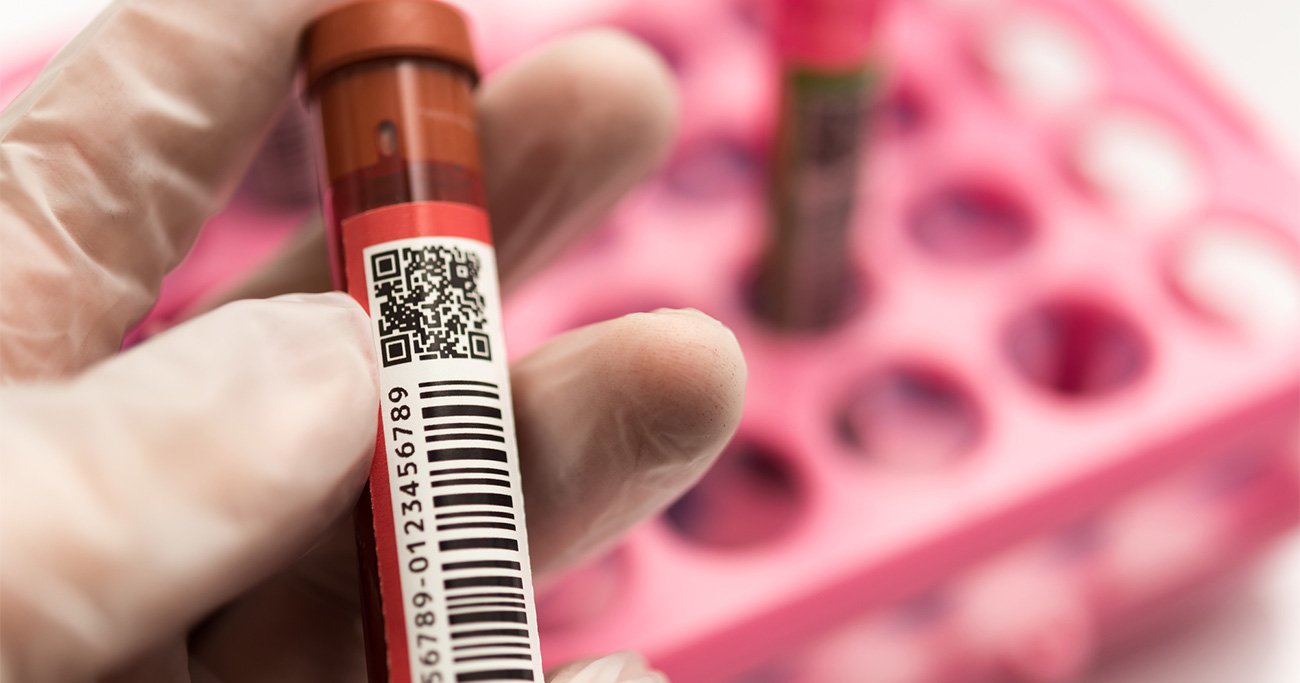 たった一度の血液検査で50種類以上のがんを早期発見できる可能性 - ヘルスデーニュース