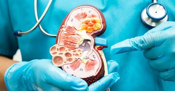 健康診断で「4つの数値」が高い人は要注意…40代から進む“見えない腎機能低下”