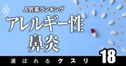 アレルギー性鼻炎で処方患者数の多い「人気薬」ランキング！花粉症で選ばれている薬は？