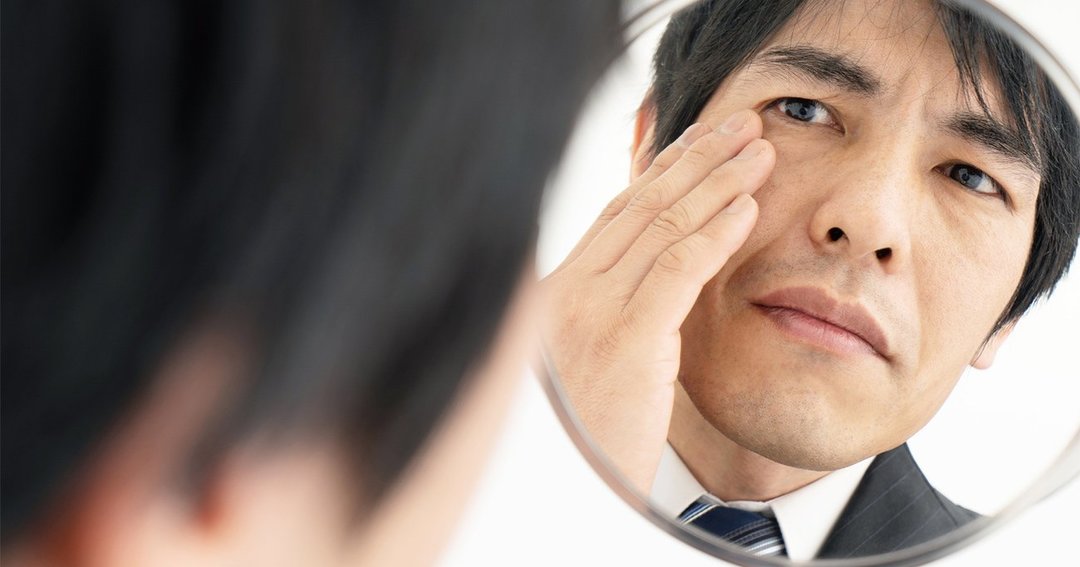 男性のシミ